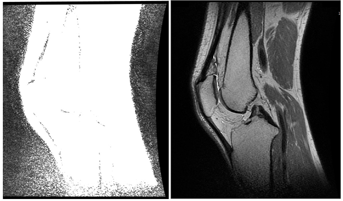 DICOM_MRI_example