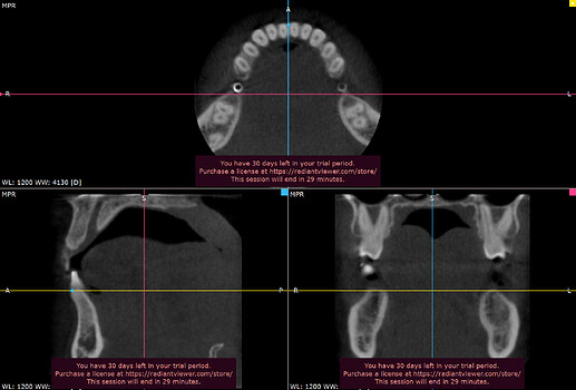 MPR Annotated