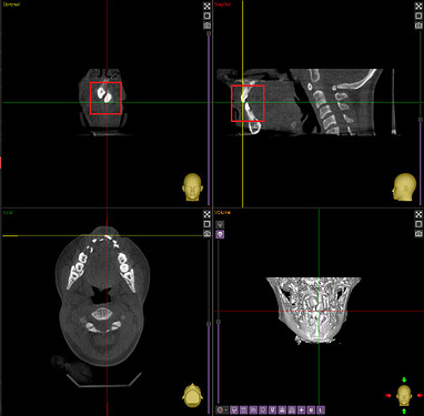 Expected Output in Coronal