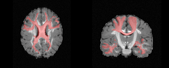 clip_plane_volume_segmentation