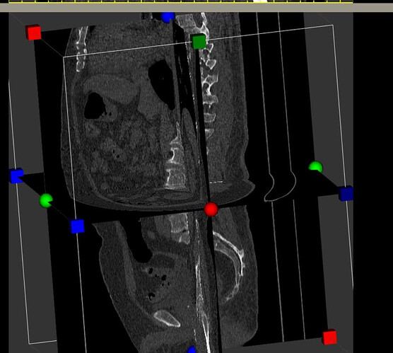 MultiSliceImageMapper Control Points